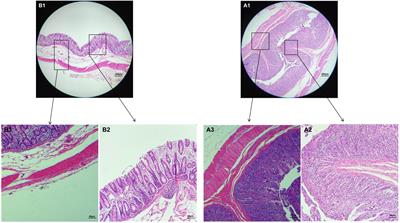 Healthy Gut Microbiome Composition Enhances Disease Resistance and Fat Deposition in Tibetan Pigs